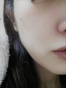 乾燥肌対策 顔 皮むけ