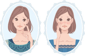 クリアポロン