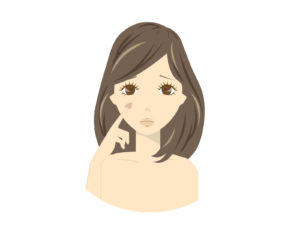 シグナリフト